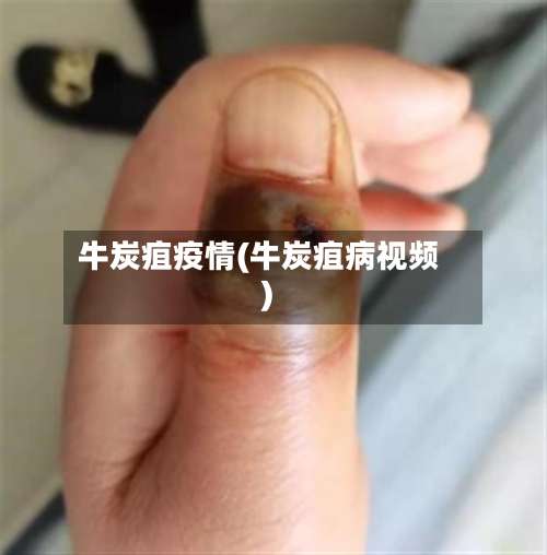 牛炭疽疫情(牛炭疽病视频)-第2张图片