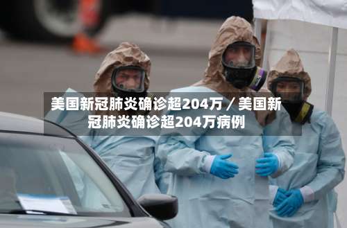 美国新冠肺炎确诊超204万/美国新冠肺炎确诊超204万病例-第1张图片