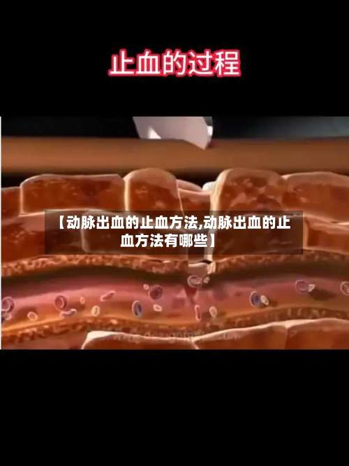 【动脉出血的止血方法,动脉出血的止血方法有哪些】-第3张图片