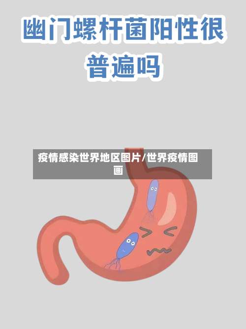 疫情感染世界地区图片/世界疫情图画-第1张图片