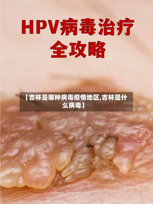 【吉林是哪种病毒疫情地区,吉林是什么病毒】-第1张图片